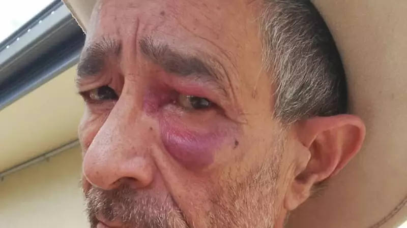 Cairns grandfather assaulted protecting child's bike in housing crisis