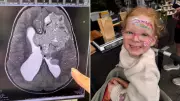 Australia's $100M Proton Beam Therapy Failure Leaves Families Stranded