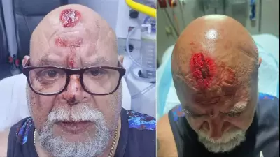 Fremantle Dockers Star's Father Traumatised After Aveley Coward Punch