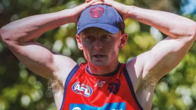 Melbourne Demons' Jake Bowey Out for Six Months with Serious Foot Injury