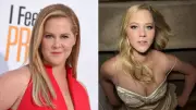 Amy Schumer Reveals 50lb Weight Loss Was to 'Survive' Cushing Syndrome