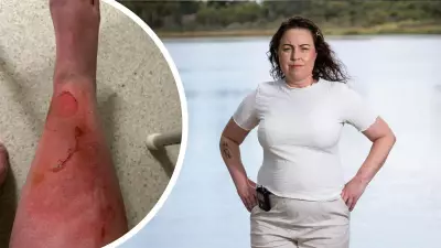 Perth mum's leg nearly amputated after jellyfish sting at Peppermint Grove Beach