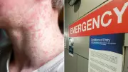 NSW and SA Issue Urgent Measles Alerts After Infectious Travellers Visit Airports, Shopping Centres