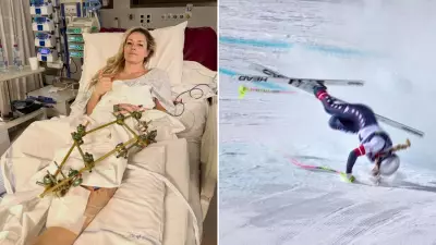 Lindsey Vonn Undergoes Third Surgery After Olympic Downhill Crash
