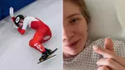 Polish Speedskater Kamila Sellier Shares Update After Face Injury Surgery