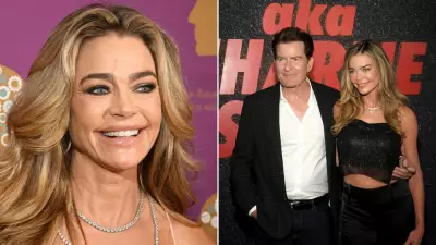 Denise Richards Opens Up About Recent Facelift and Cosmetic Procedures