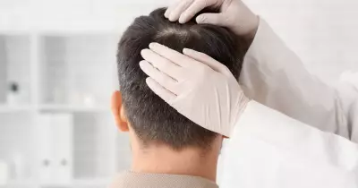 Hairline Planning in Hair Transplants: Key Insights on Symmetry and Clinical Assessment