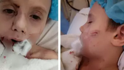 Hero Tradesmen Save Young Boy from Savage Dog Attack in Cairns