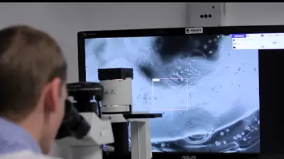 Modern Diets Under Scrutiny as Bowel Cancer Surges in Young Australians