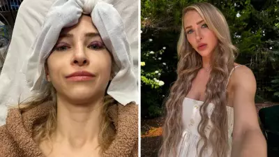 TikTok Star Alix Lynx Reveals Breast Implant 'Secret' After Three Surgeries