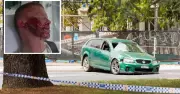 St Edmund's College Hit-and-Run Exposes Critical Policing Failures in Canberra