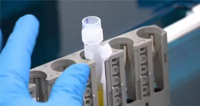 Australian Trial Combines Blood and Online Tests for Early Alzheimer's Detection