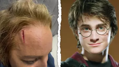 Carrie Bickmore's Forehead Injury Sparks 'Carrie Potter' Nickname from Fans