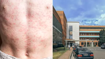 Measles Alert in Sydney After Infected Traveller Returns from Japan