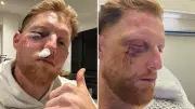 England's Ben Stokes Reveals Near-Fatal Cricket Ball Injury and Recovery Journey