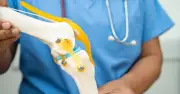 Knee Replacement Recovery Takes Longer Than Most Expect: Full Timeline