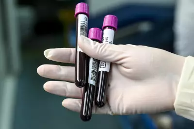 Thousands of Sydney Dentist Patients Urged to Get Blood Tests