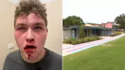 Autistic teen bashed by youths in Sydney park while trying to make friends
