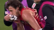Essendon Captain Andy McGrath Hospitalized with Suspected Broken Jaw