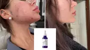 La Roche-Posay Mela B3 Serum Drops to $54.39 at Amazon Australia