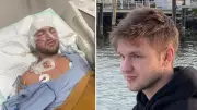 Mystery surrounds Australian's severe injuries in Indonesia