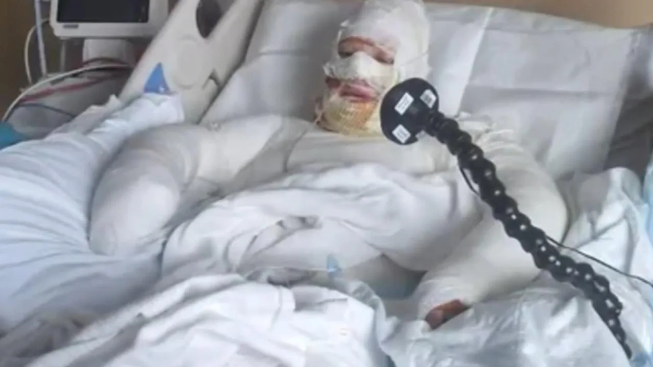 Mandurah Mother Firebombed Twice Suffers Horrific Burns