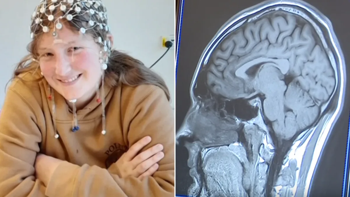 New Concussion Guidelines Transform GP Treatment in Australia