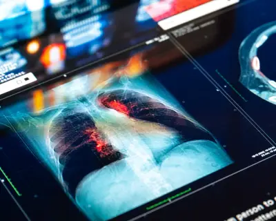 Doctors and NHS Could Be Sued for AI Mistakes, Report Warns