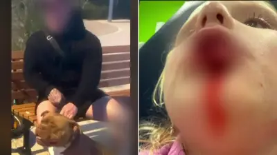 Girl, 4, undergoes plastic surgery after dog attack in Sydney park