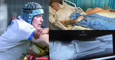 Queanbeyan Whites Star Arley Moore Suffers Broken Leg in ACT Rugby