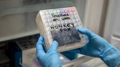 US Scientists Charged for Smuggling Mpox Vials from Africa