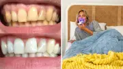Aussies Save Big with SmilePro's 60% Off Teeth Whitening Kit
