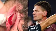 Kalyn Ponga's Gruesome Ear Injury Reveals Truth Behind Origin Incident