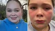 Mother urges second opinion after daughter's rare eye disease misdiagnosed