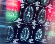 Study Finds Non-Opioid Painkillers Equally Effective for Many Conditions