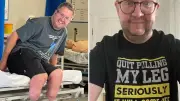 Surgeon who used dry ice to amputate his own legs struck off medical register