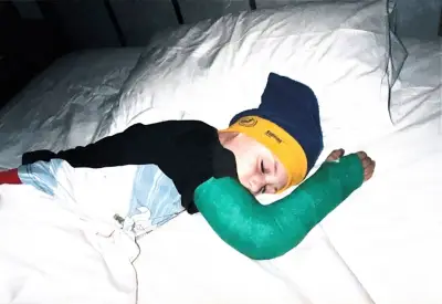 Broken Arm Seven Times Finally Heeded Body's Warning