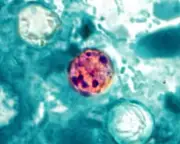 US Cyclosporiasis Cases Surge: Michigan Reports 700 Parasitic Illnesses